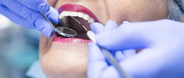 Best Emergency Treatment for Dental Infections or Abscesses in Sykesville, MD